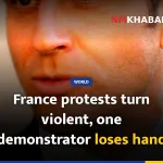 France protests turn violent, one demonstrator loses hand